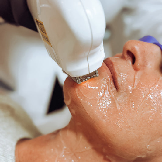 Fotorejuvenescimento